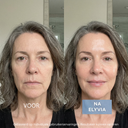 ELYVIA - The 90 Day Skin Reset