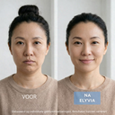 ELYVIA - The 90 Day Skin Reset