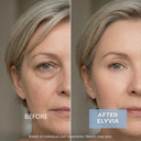 ELYVIA Complete Skin System™