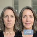 ELYVIA Complete Skin System™