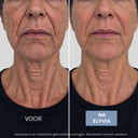 ELYVIA - The 90 Day Skin Reset