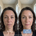 ELYVIA - The 90 Day Skin Reset