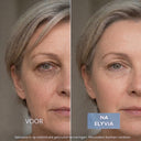 ELYVIA - The 90 Day Skin Reset