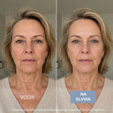 ELYVIA - The 90 Day Skin Reset